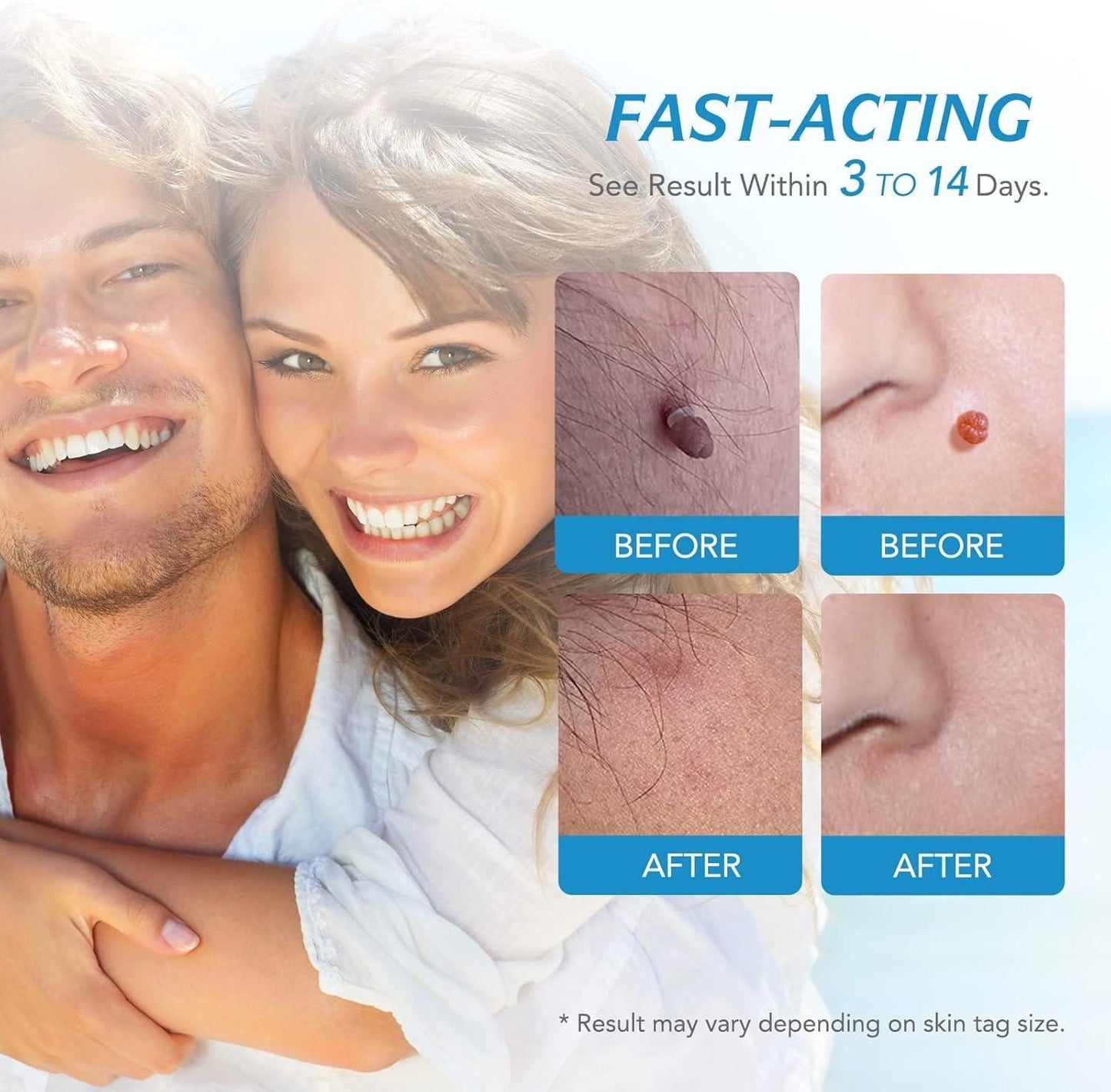 Happy couple with before and after close-up images showing fast-acting 2 in 1 skin tag remover results within 3 to 14 days