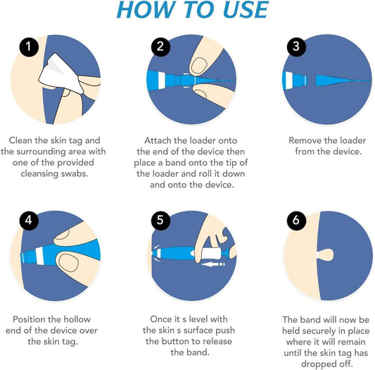 Illustrated step-by-step guide for painless 2 in 1 skin tag remover kit application with blue device and instructions.